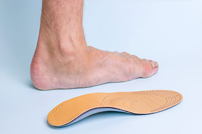 flat feet problems